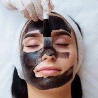 Carbon laser facial treatment at YAS Cosmetology