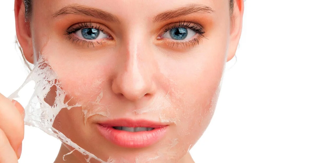 Chemical Peels at YAS Cosmetology